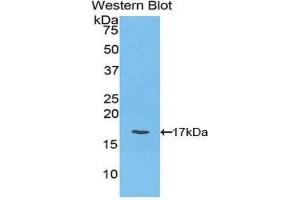 Western Blotting (WB) image for anti-Ly1 Antibody Reactive (LYAR) (AA 271-386) antibody (ABIN1859730) (LYAR anticorps  (AA 271-386))