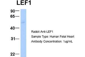 Host:  Rabbit  Target Name:  LEF1  Sample Type:  Human Fetal Heart  Antibody Dilution:  1. (LEF1 anticorps  (Middle Region))