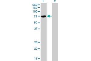 Western Blot analysis of CBFA2T2 expression in transfected 293T cell line by CBFA2T2 monoclonal antibody (M15), clone 2C10. (CBFA2T2 anticorps  (AA 201-304))