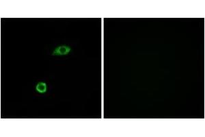 Immunofluorescence analysis of A549 cells, using OR1B1 Antibody. (OR1B1 anticorps  (AA 161-210))