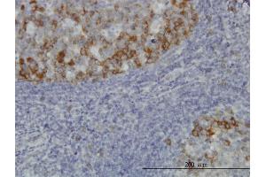 Immunoperoxidase of monoclonal antibody to BUB1B on formalin-fixed paraffin-embedded human tonsil. (BUB1B anticorps  (AA 1-130))