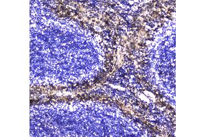 IHC analysis of S100A10 using anti-S100A10 antibody .