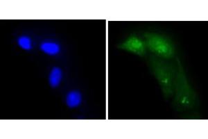 ICC/IF analysis of ADK in A549 cells line, stained with DAPI (Blue) for nucleus staining and monoclonal anti-human ADK antibody (1:100) with goat anti-mouse IgG-Alexa fluor 488 conjugate (Green).