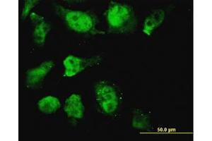 Image no. 3 for anti-Homeobox D11 (HOXD11) (AA 1-77) antibody (ABIN599383) (HOXD11 anticorps  (AA 1-77))