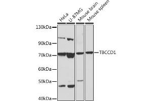 Western blot analysis of extracts of various cell lines, using TBCCD1 Rabbit pAb (ABIN7270751) at 1:1000 dilution.