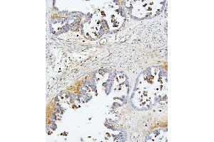 IHC analysis of TEK using anti-TEK antibody (ABIN7600762). (TEK anticorps  (AA 23-616))