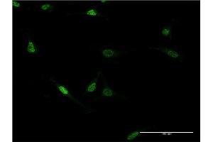 Immunofluorescence of monoclonal antibody to ZNF76 on HeLa cell. (ZNF76 anticorps  (AA 471-570))