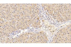 Detection of ADRP in Human Liver Tissue using Polyclonal Antibody to Adipose Differentiation Related Protein (ADRP)