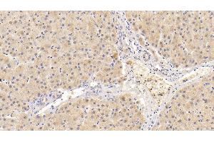 Detection of ADRP in Human Liver Tissue using Polyclonal Antibody to Adipose Differentiation Related Protein (ADRP) (ADRP anticorps  (AA 5-232))