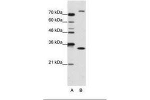 Image no. 1 for anti-Exosome Component 2 (EXOSC2) (N-Term) antibody (ABIN202179) (EXOSC2 anticorps  (N-Term))