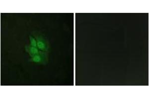 Immunofluorescence analysis of HeLa cells, using p53 (Phospho-Ser392) Antibody. (p53 anticorps  (pSer392))
