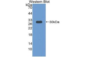 Western blot analysis of the recombinant protein. (Paxillin anticorps  (AA 347-578))