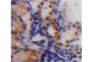 IHC-P analysis of Kidney tissue, with DAB staining. (IGFBP2 anticorps  (AA 35-304))