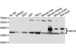 Western blot analysis of extracts of various cells, using NACA antibody. (NACA anticorps)