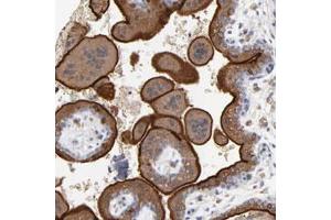 Immunohistochemical staining (Formalin-fixed paraffin-embedded sections) of human placenta with PDLIM2 polyclonal antibody  shows strong membranous and cytoplasmic positivity in trophoblastic cells. (PDLIM2 anticorps)