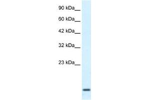 WB Suggested Anti-HOXA1 Antibody Titration:  2. (HOXA1 anticorps  (Middle Region))