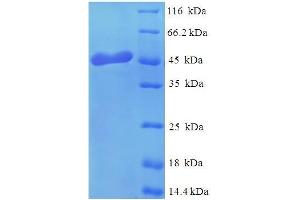 SDS-PAGE (SDS) image for Osteoglycin (OGN) (AA 21-298) protein (His tag) (ABIN5710041) (OGN Protein (AA 21-298) (His tag))