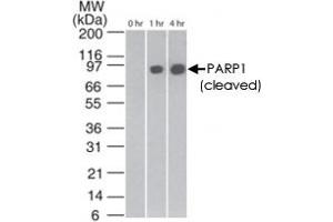Western blot analysis of cleaved PARP1 in staurosporin-treated Jurkat cells at various time points, using PARP1 monoclonal antibody, clone 194C1439  at 2 ug/mL . (PARP1 anticorps  (Cleavage Site))