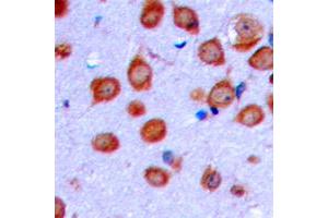 Immunohistochemical analysis of OLFML2A staining in human brain formalin fixed paraffin embedded tissue section. (OLFML2A anticorps  (Center))