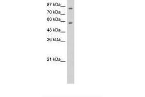 Image no. 1 for anti-Zinc Finger Protein 777 (ZNF777) (C-Term) antibody (ABIN6736254) (ZNF777 anticorps  (C-Term))