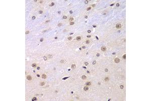 Immunohistochemistry of paraffin-embedded mouse brain using RNF2 antibody (ABIN5973244) at dilution of 1/100 (40x lens).