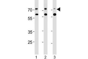 Acetylcholinesterase antibody western blot analysis in human 1) Jurkat, 2) Raji and 3) Y79 lysate. (Acetylcholinesterase anticorps  (AA 147-175))