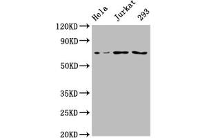 Western Blot Positive WB detected in: Hela whole cell lysate, Jurkat whole cell lysate, 293 whole cell lysate All lanes: INTS9 antibody at 1:2000 Secondary Goat polyclonal to rabbit IgG at 1/50000 dilution Predicted band size: 74, 72 kDa Observed band size: 74 kDa (INTS9 anticorps  (AA 368-658))