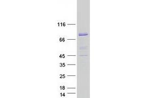 Validation with Western Blot