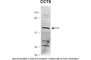 Sample Type: HEK 293 (10ug)Primary Dilution: 1:1000Secondary Antibody: conjugated goat anti-rabbitSecondary Dilution: 1:10,000Image Submitted By: Amy GrayBrigham Young University (CCT8 anticorps  (C-Term))
