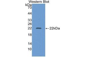 Western Blotting (WB) image for anti-Alanine Aminotransferase (ALT) (AA 581-738) antibody (ABIN1862085) (ALT anticorps  (AA 581-738))