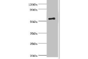 Western blot All lanes: Zinc finger protein Aiolos antibody at 8 μg/mL + HepG2 whole cell lysate Secondary Goat polyclonal to rabbit IgG at 1/10000 dilution Predicted band size: 59, 52, 54, 30, 48, 50, 55, 42, 36, 33, 43, 31 kDa Observed band size: 59 kDa (IKZF3 anticorps  (AA 280-450))
