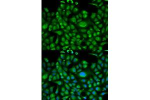 Immunofluorescence analysis of U2OS cells using HSPA1L antibody (ABIN5970952). (HSPA1L anticorps)