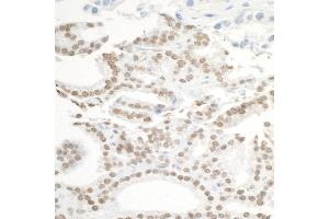 Immunohistochemistry (IHC) image for anti-Bromodomain Containing 3 (BRD3) (AA 676-726) antibody (ABIN7453851) (BRD3 anticorps  (AA 676-726))