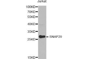 Western Blotting (WB) image for anti-Synaptosomal-Associated Protein, 29kDa (SNAP29) antibody (ABIN1874886) (SNAP29 anticorps)