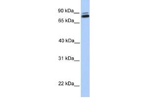 WB Suggested Anti-GGTL3 Antibody Titration:  0. (GGT7 anticorps  (C-Term))