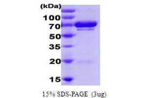 SDS-PAGE (SDS) image for Ubiquitin-Conjugating Enzyme E2G 2 (UBE2G2) protein (ABIN666841) (UBE2G2 Protéine)
