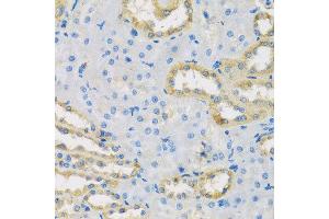 Immunohistochemistry of paraffin-embedded rat kidney using HS1BP3 antibody at dilution of 1:100 (x40 lens). (HS1BP3 anticorps)
