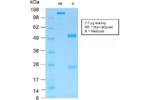 SDS-PAGE Analysis Purified MUC6 Rabbit Recombinant Monoclonal Antibody (MUC6/1553R). (Recombinant MUC6 anticorps)