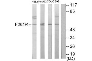 Western blot analysis of extracts from HeLa cells, HepG2 cells, COLO205 cells and 293 cells, using PFKFB1/4 antibody. (PFKFB1/4 anticorps  (Internal Region))