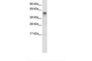Image no. 1 for anti-Jumonji Domain Containing 5 (JMJD5) (C-Term) antibody (ABIN6735928) (JMJD5 anticorps  (C-Term))