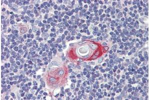 Thymus, Human: Formalin-Fixed, Paraffin-Embedded (FFPE) (CPXCR1 anticorps  (AA 396-445))
