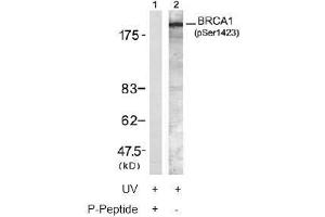 Image no. 2 for anti-Breast Cancer 1 (BRCA1) (pSer1423) antibody (ABIN196994) (BRCA1 anticorps  (pSer1423))