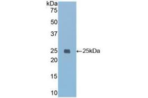 Western blot analysis of recombinant Mouse IGFBP7. (IGFBP7 anticorps  (AA 88-281))