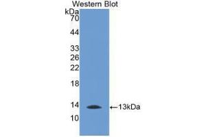 Western blot analysis of recombinant Human MTNR1A. (Melatonin Receptor 1A anticorps  (AA 296-350))