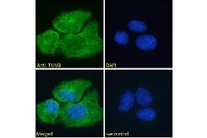 ABIN1590057 Immunofluorescence analysis of paraformaldehyde fixed U2OS cells, permeabilized with 0. (TNNI3 anticorps  (AA 117-127))