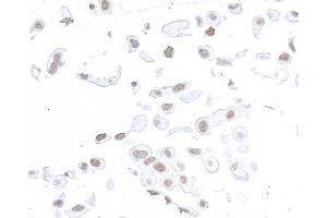 Immunocytochemistry (ICC) image for anti-Structural Maintenance of Chromosomes 1A (SMC1A) (C-Term) antibody (ABIN7455193) (Recombinant SMC1A anticorps  (C-Term))