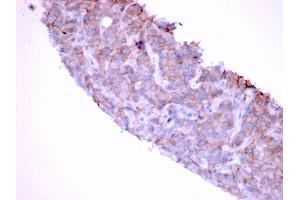 Formalin-fixed, paraffin-embedded human Bladder stained with EGFR Mouse Monoclonal Antibody (GFR/1667). (EGFR anticorps)