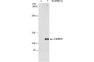 WB Image CARD12 antibody detects CARD12 protein by western blot analysis.