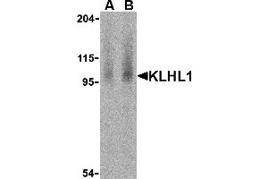 Western Blotting (WB) image for anti-Kelch-Like 1 (KLHL1) (N-Term) antibody (ABIN1031428) (KLHL1 anticorps  (N-Term))