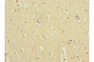 Immunohistochemistry of paraffin-embedded human brain tissue using ABIN7144208 at dilution of 1:100 (ANKS1B anticorps  (AA 999-1248))